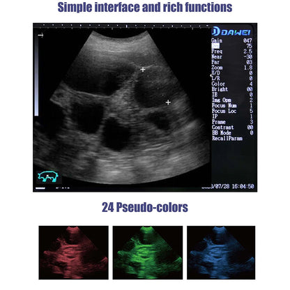 Handheld Vet Ultrasound Machine for Small Pet Dogs and Cats